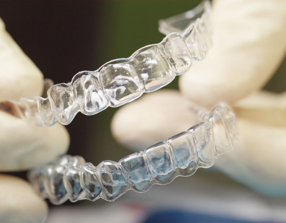 invisalign - aparat ortodontyczny - invisalign niewidoczny aparat